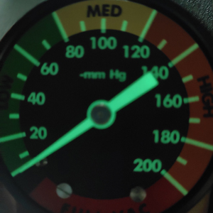 industrial differential pressure gauge product